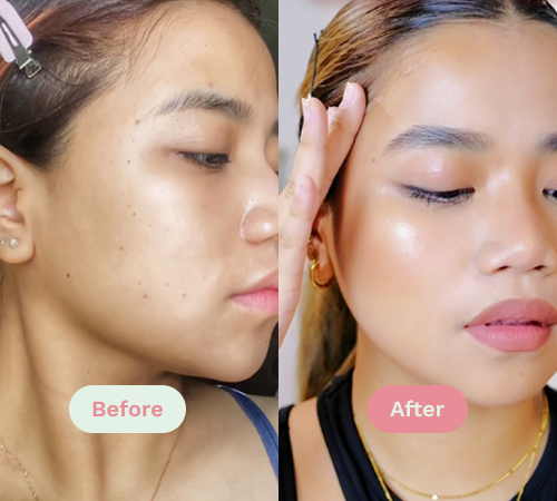 Before/After image