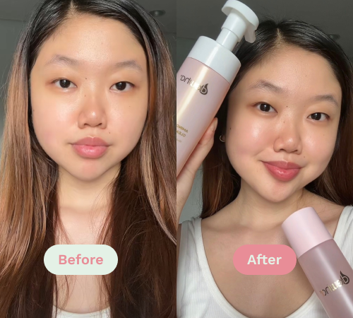 Before/After image