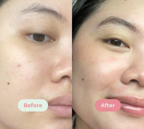 Before/After image