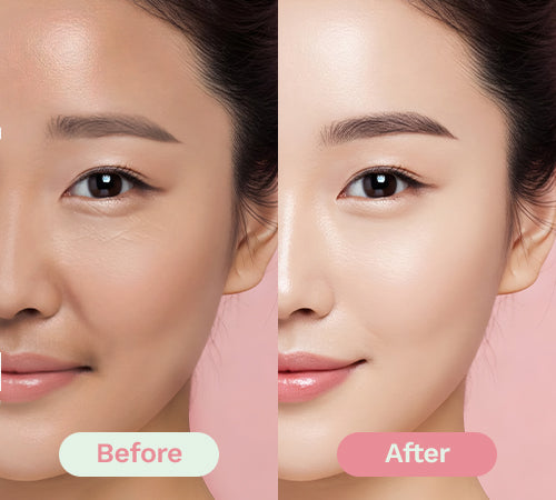 Before/After image