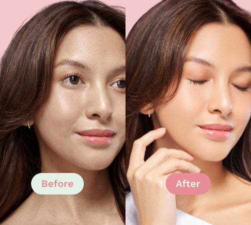 Before/After image