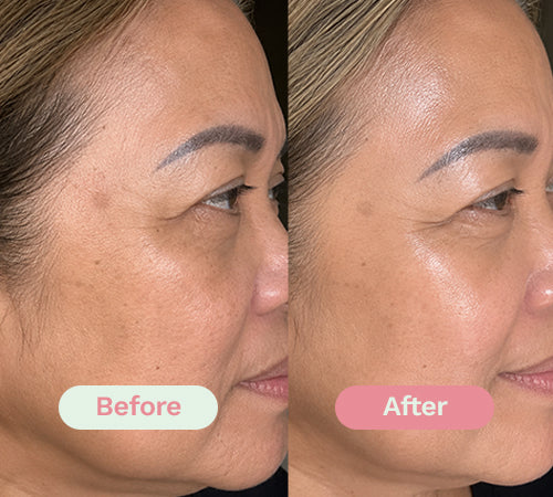 Before/After image