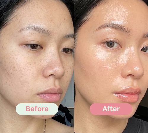 Before/After image