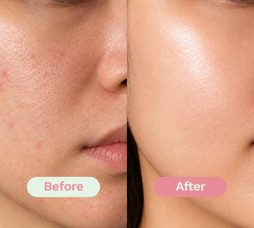 Before/After image