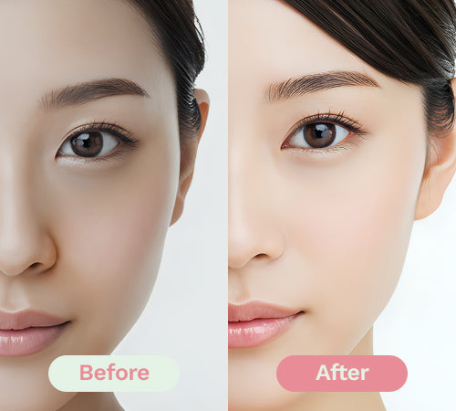 Before/After image